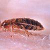 NYCHA Finally Exterminates Woman's Month-Old Bed Bugs